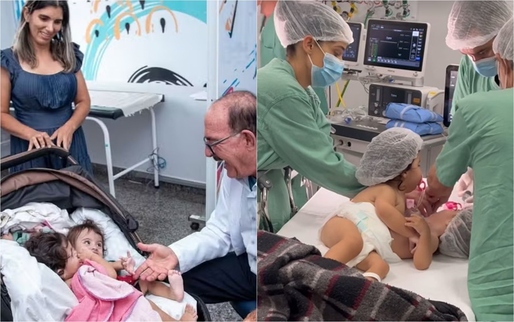 Irmã de siamesa que morreu após cirurgia de separação está sedada em estado grave, diz hospital