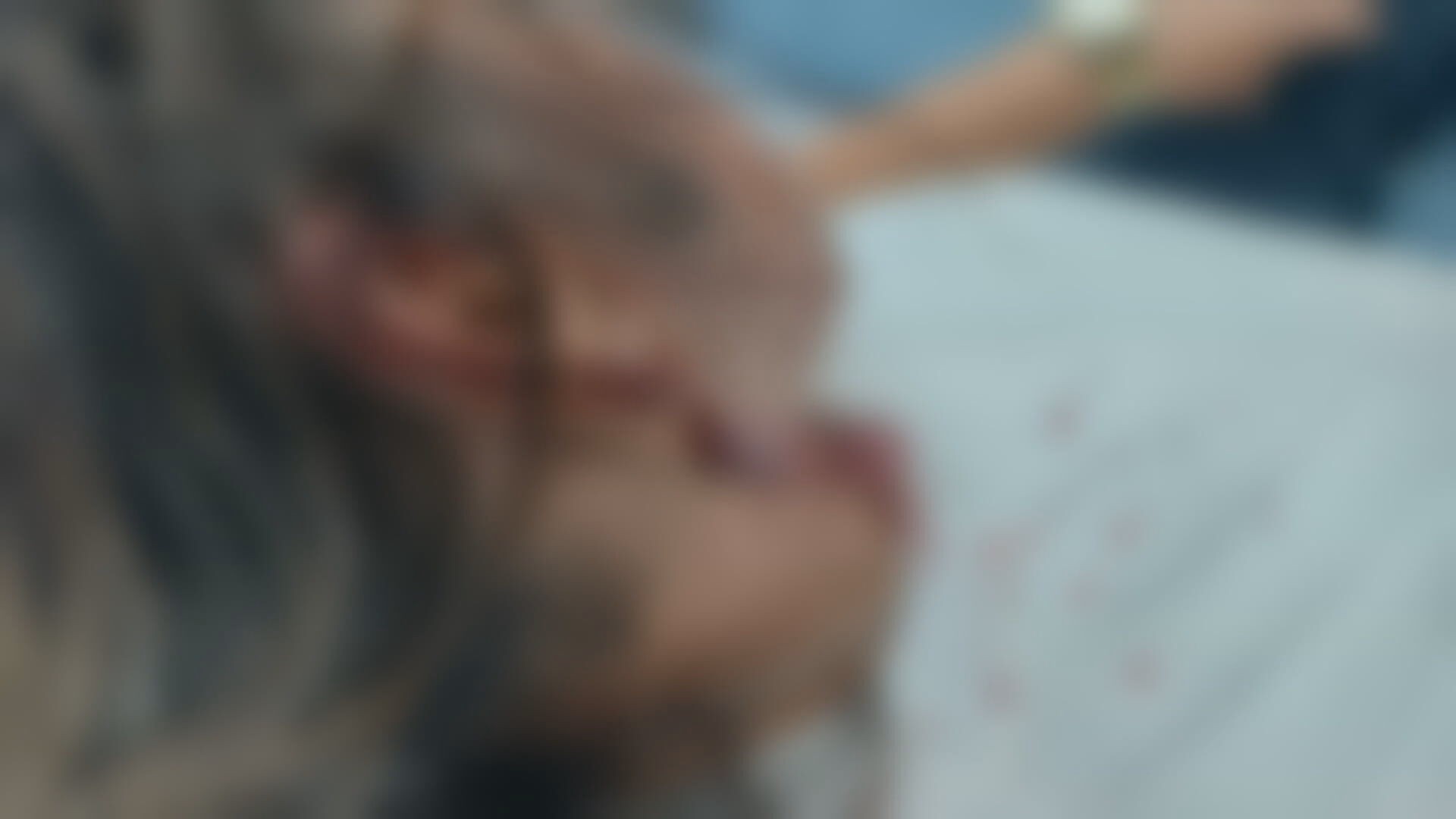 Mulher relata ataque de pitbull ao tentar ajudar outro cachorro em Marechal Hermes