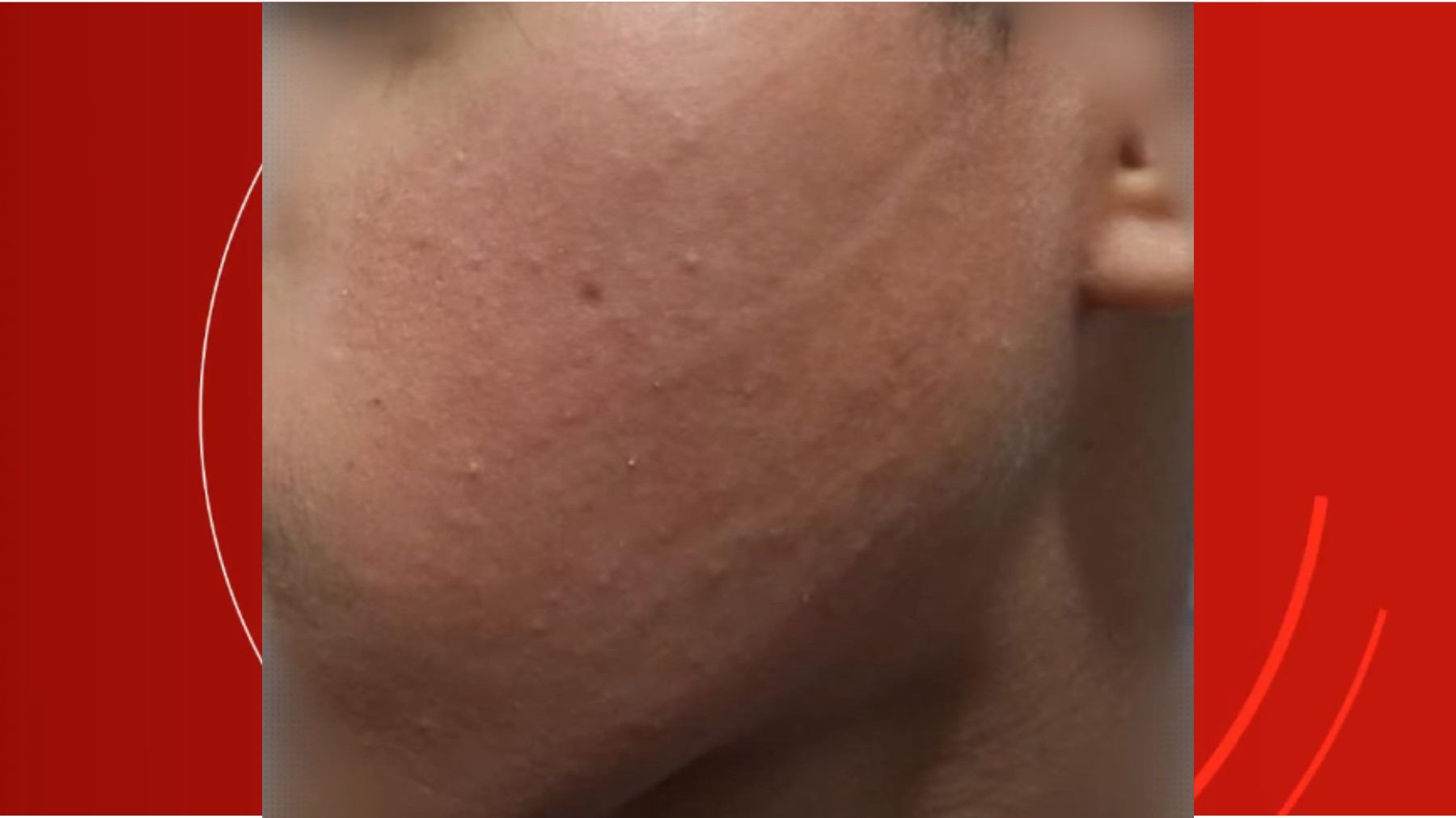 Mãe diz que filho de 13 anos foi agredido dentro de colégio por policial da patrulha escolar no Paraná