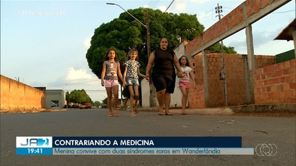 Criança dá volta por cima após diagnóstico de síndrome rara; conheça história