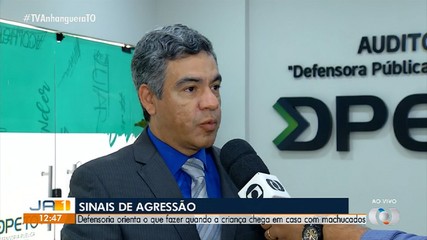 Defensoria orienta o que fazer quando a criança chega em casa com machucados