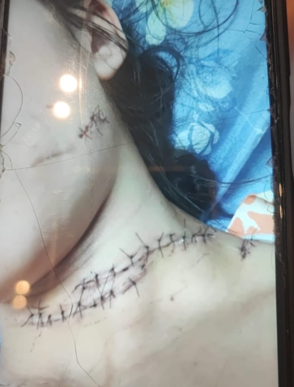 Polícia prende suspeito de tentar matar ex-companheira a facadas enquanto ela dormia em Maceió