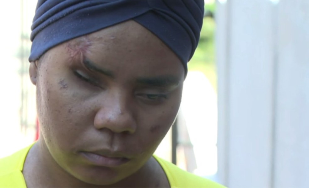 Raísa Santos está grávida e perdeu a visão após ser atingida por tiro e estilhaços de bomba — Foto: Reprodução/TV Bahia
