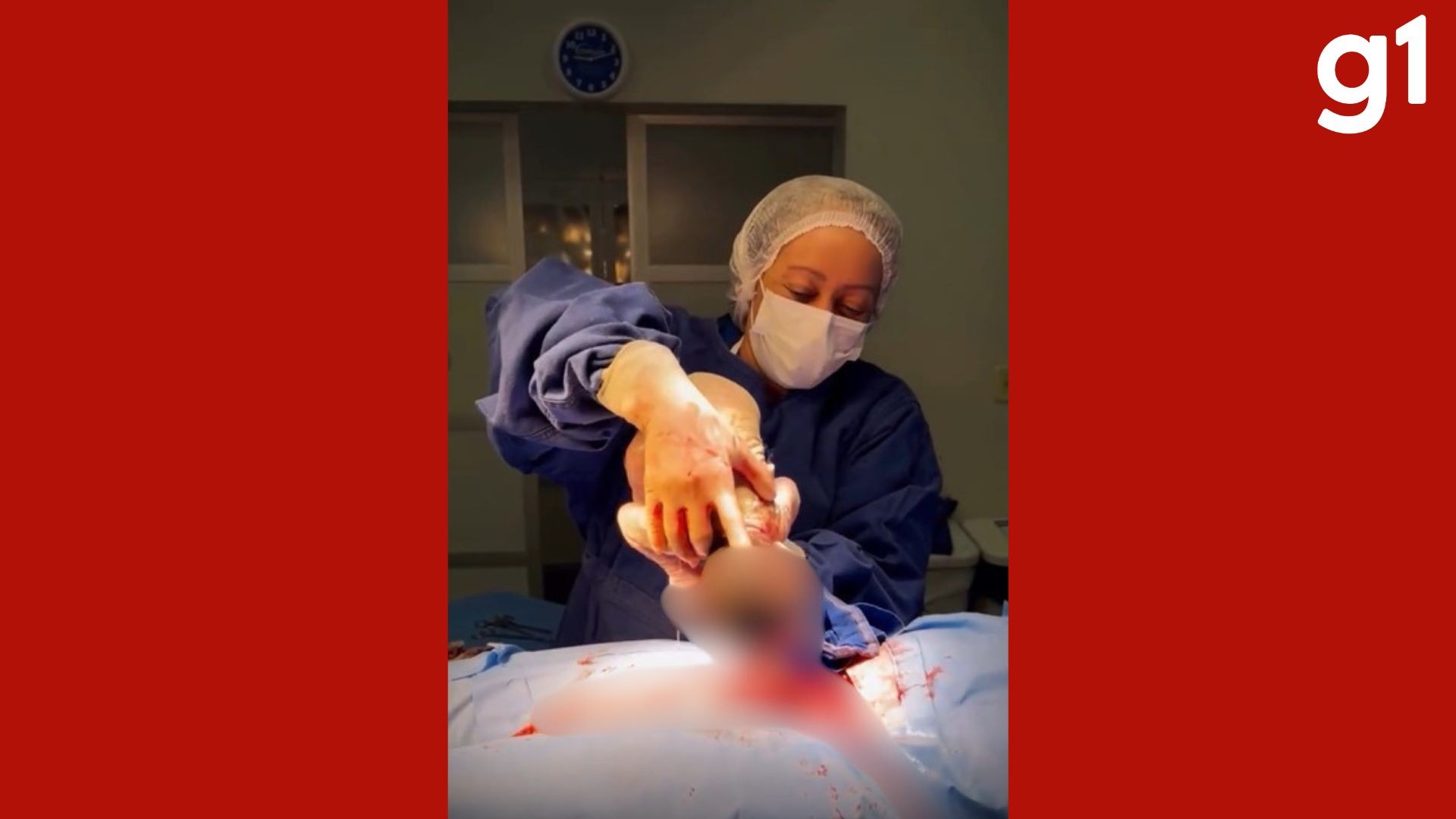 Vídeo: bebê ‘nasce dentro de bolha’ em parto raro em MT