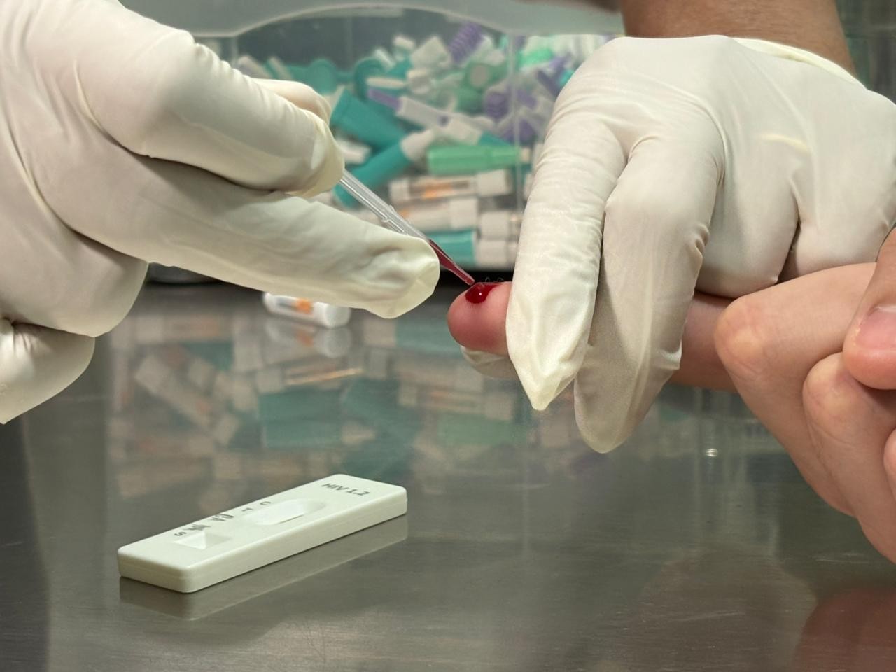 Casos de infecção por HIV no Amapá tem alta de 6% em 2025 e superam total do ano anterior