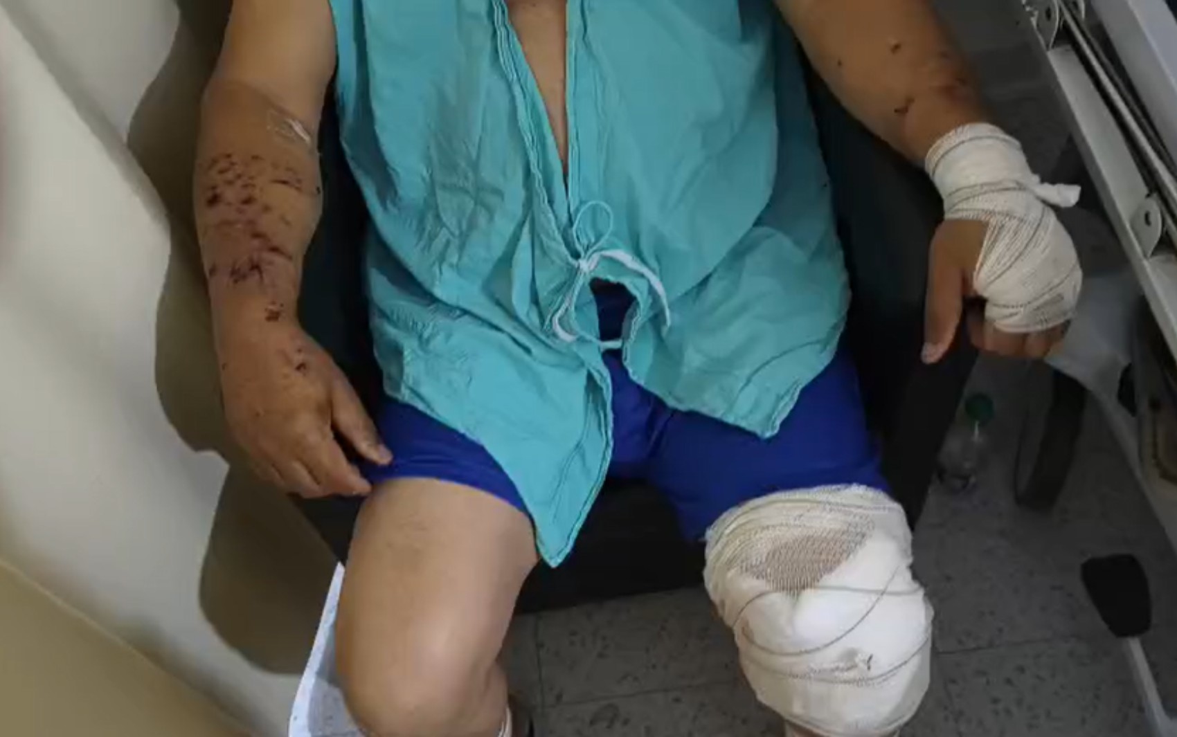 Homem é atacado por pitbull durante caminhada em parque em Altinópolis, SP