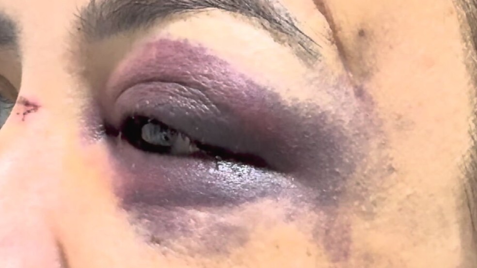 Mulher tem costelas quebradas após ser espancada pelo marido em Rio Preto (SP) — Foto: Reprodução/TV TEM