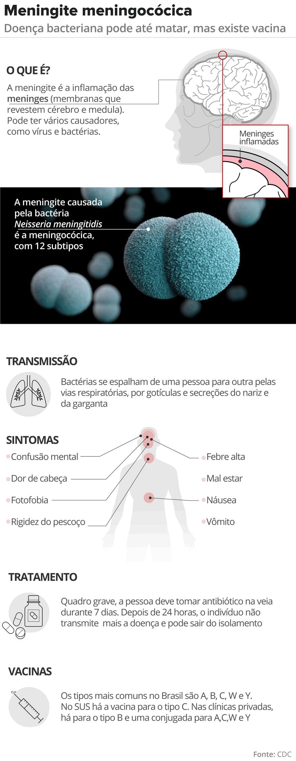 Meningite tipo C: entenda a doença que causou a morte de uma menina de 11  anos | G1