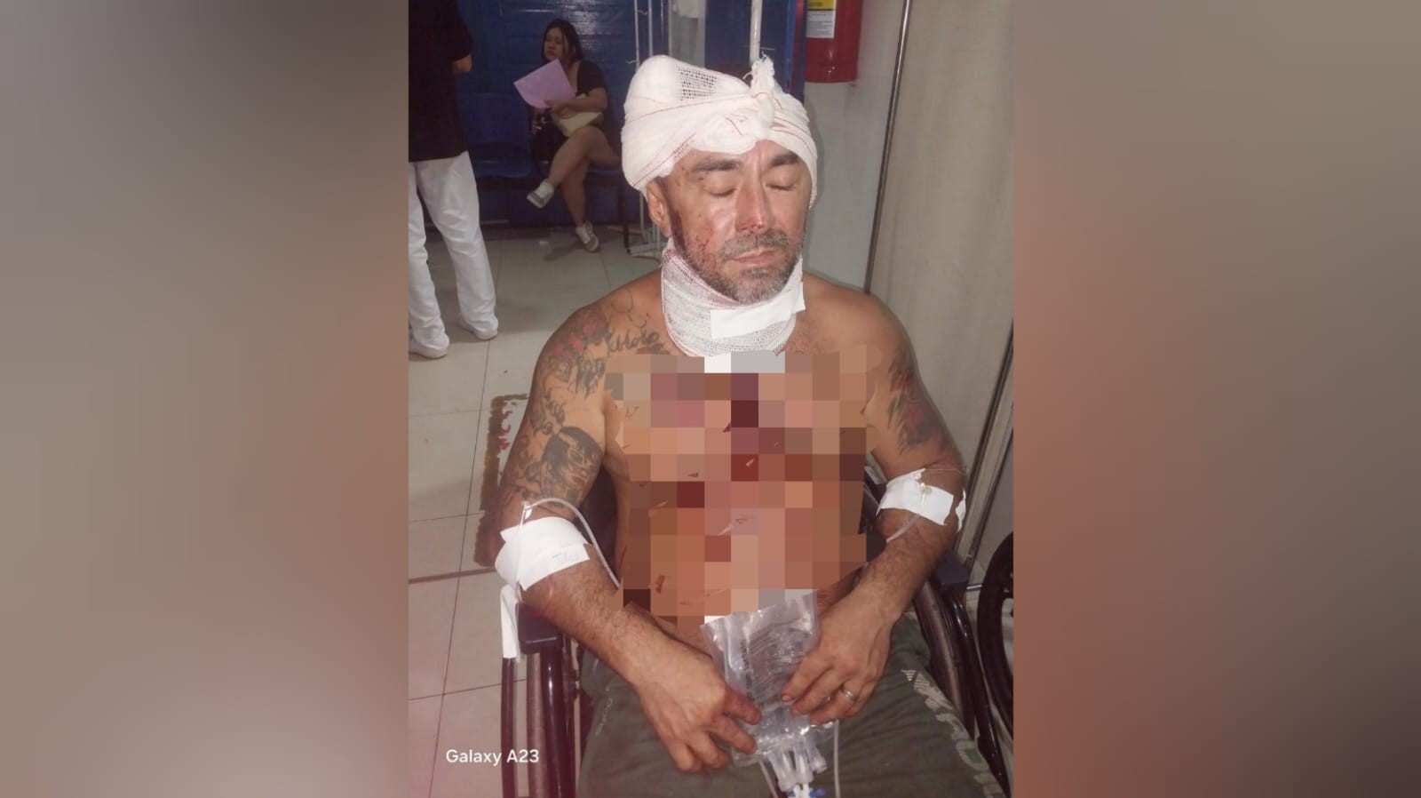 Homem sofre tentativa de homicídio em Alter do Chão; suspeito é preso