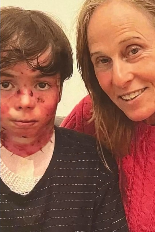 Morre Theo Colker, neto de Deborah Colker, que se tratava de doença rara: 'Guerreiro que se tornou luz'