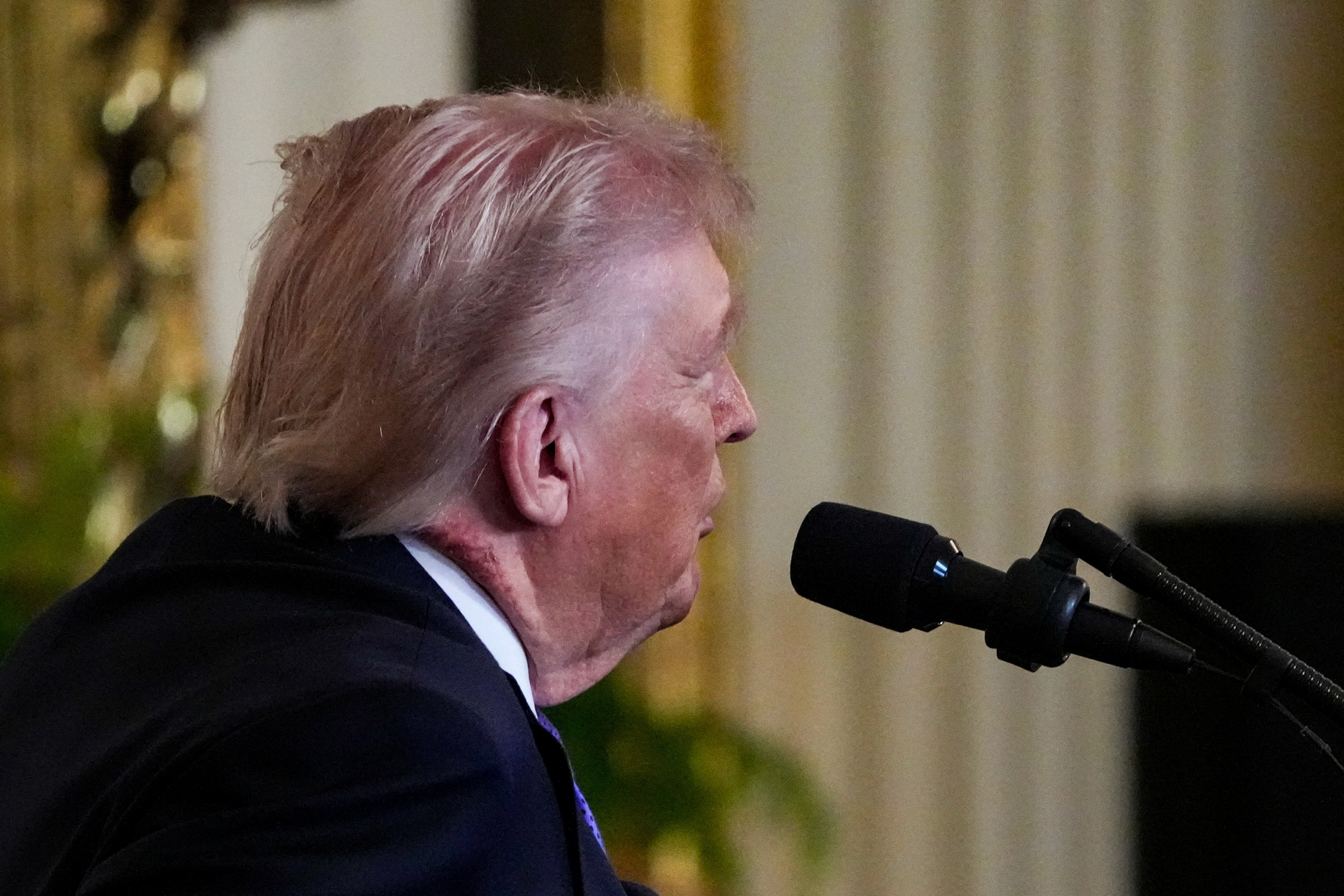 Trump aparece em público com hematoma no pescoço durante cerimônia na Casa Branca