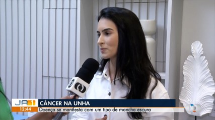Especialista explica os sintomas do câncer de unha e os tipos de tratamento