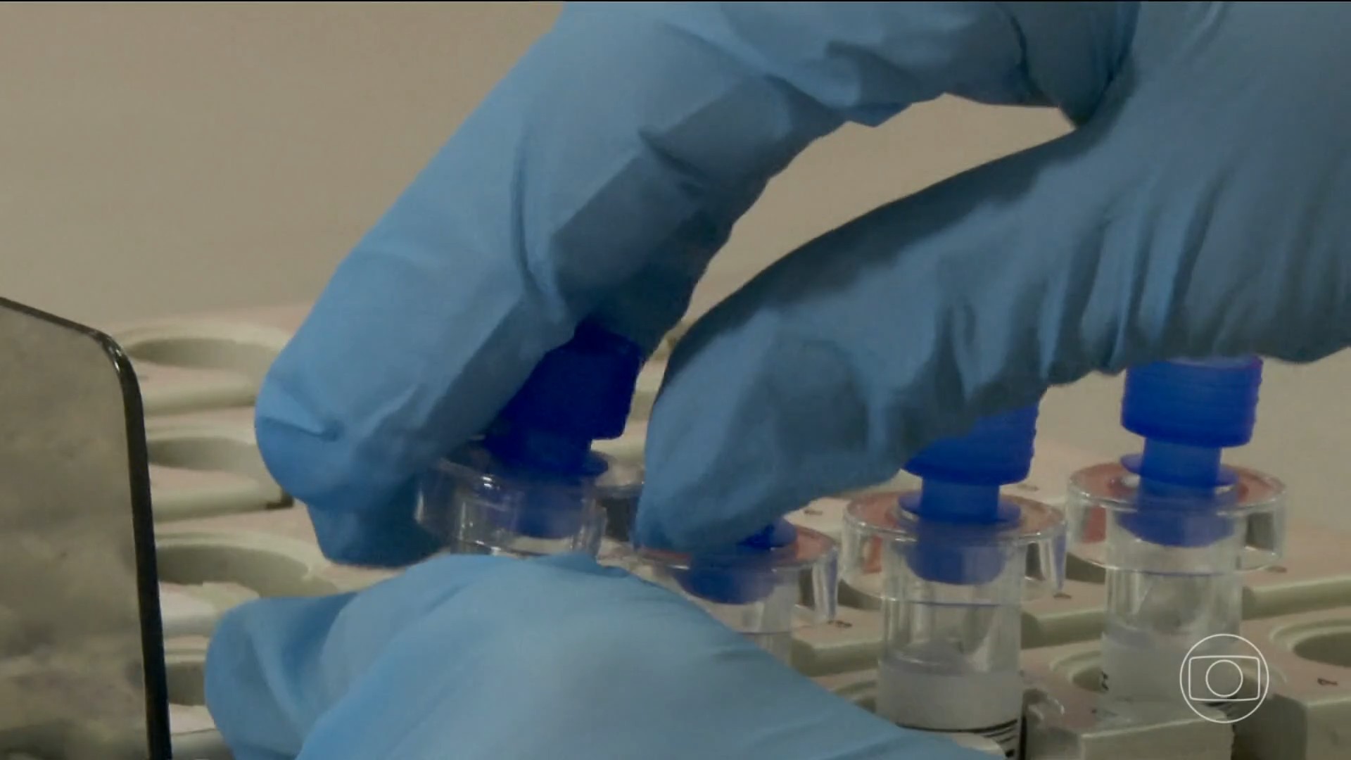Teste genético que identifica risco hereditário de câncer de mama chega ao SUS