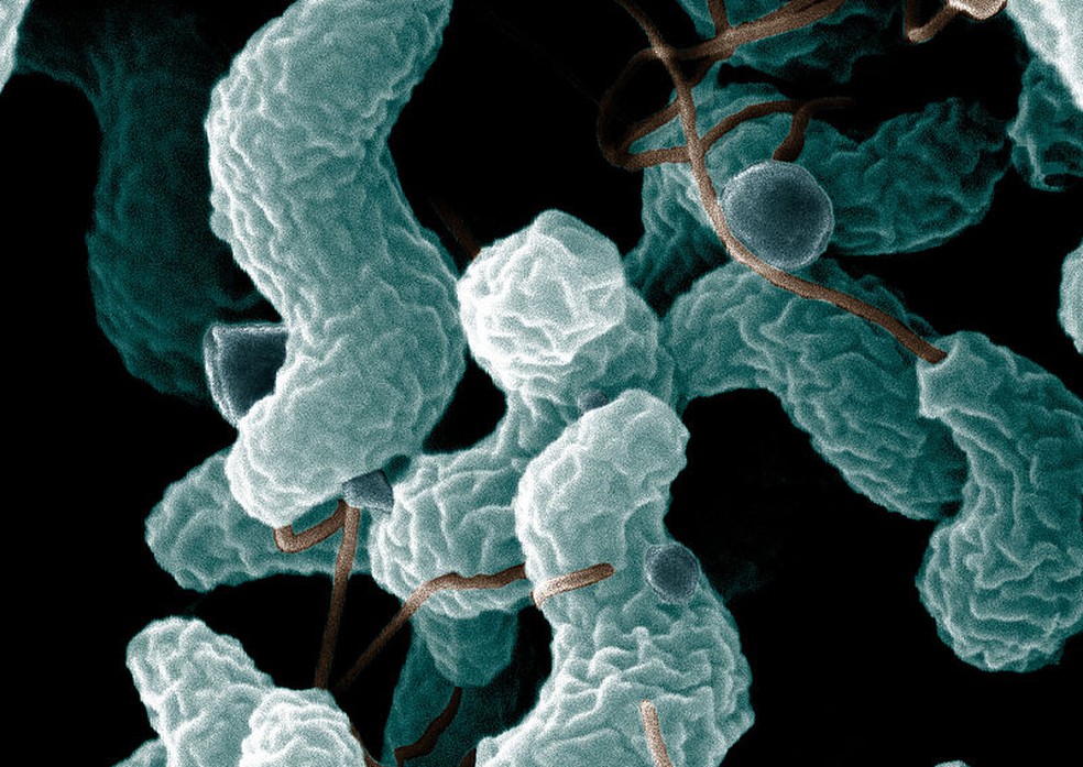 Imagem de microscópio eletrônico mostra bactéria Campylobacter jejuni, que desencadeia cerca de 30% dos casos de síndrome de Guillain-Barré. — Foto: Domínio Público