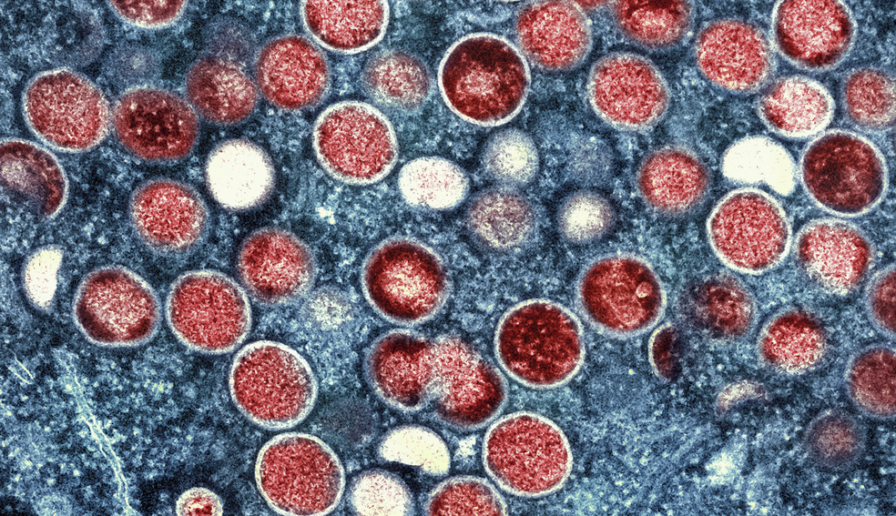 Partículas do vírus da mpox vistas em microscópio eletrônico. — Foto: NIAID via AP, File