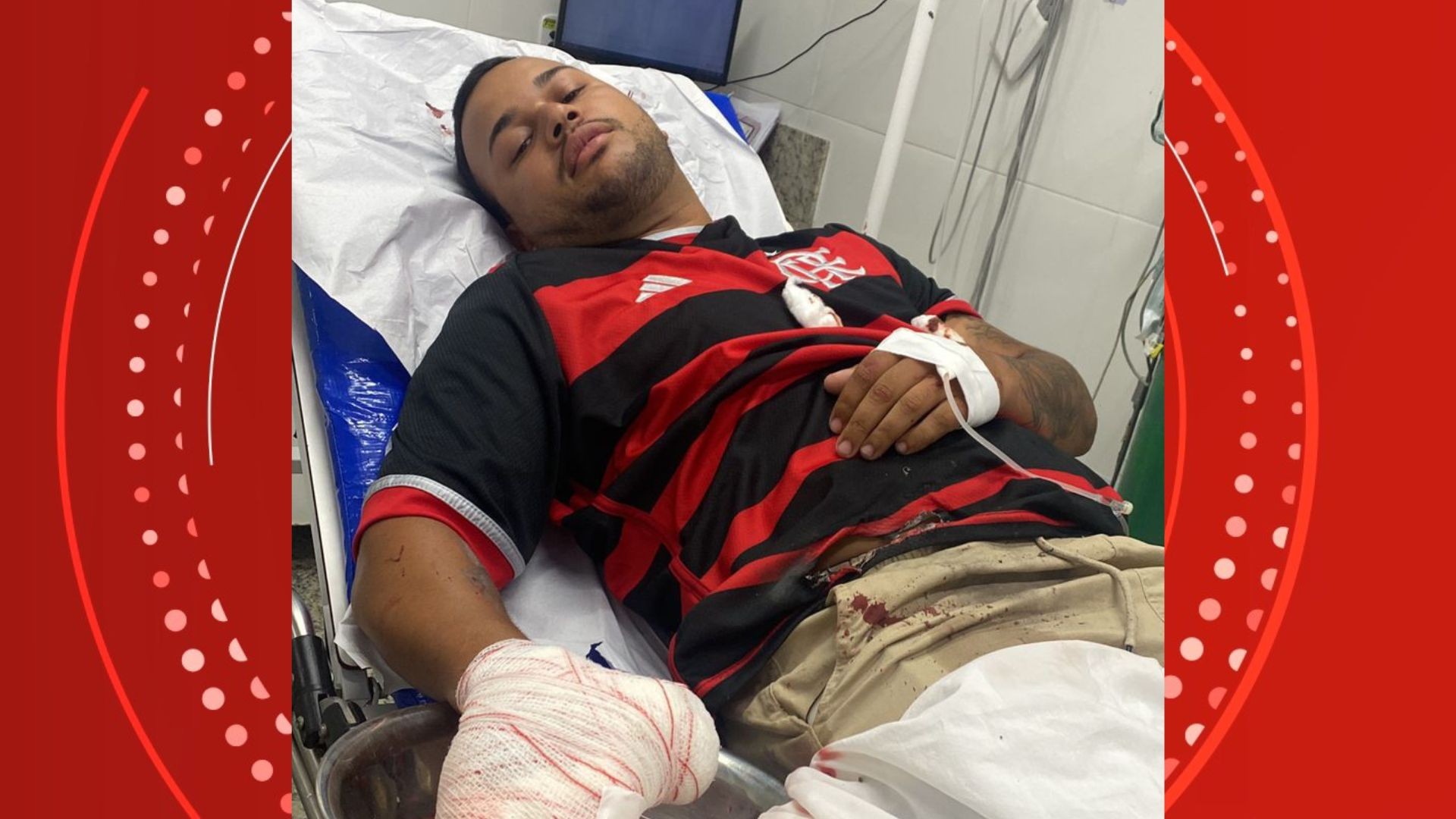 Torcedor do Flamengo tem dedo amputado em explosão de fogos na comemoração da Libertadores no ES