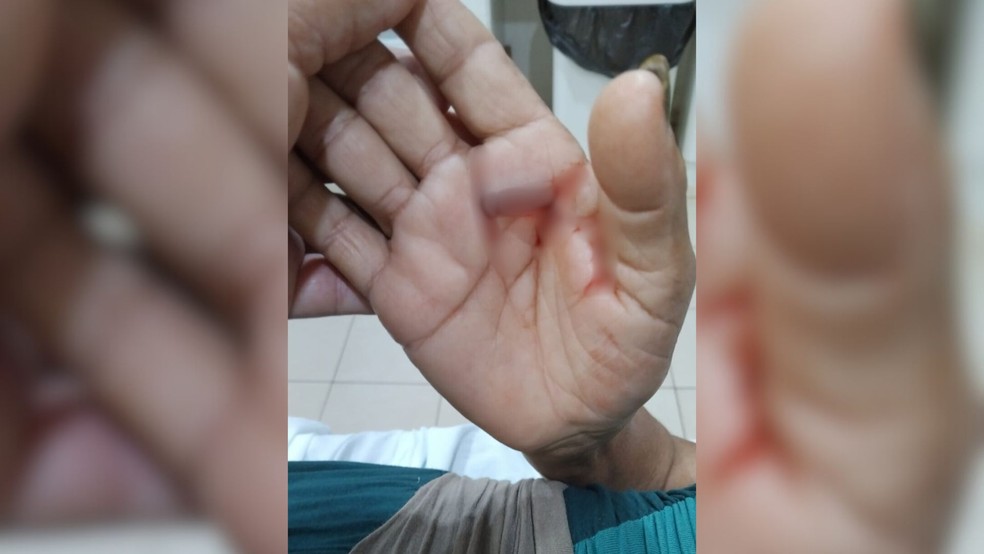 Idosa de 67 anos é atacada por pitbull no interior de SP e tutora do animal vai responder por omissão de cautela — Foto: Polícia Civil/Divulgação