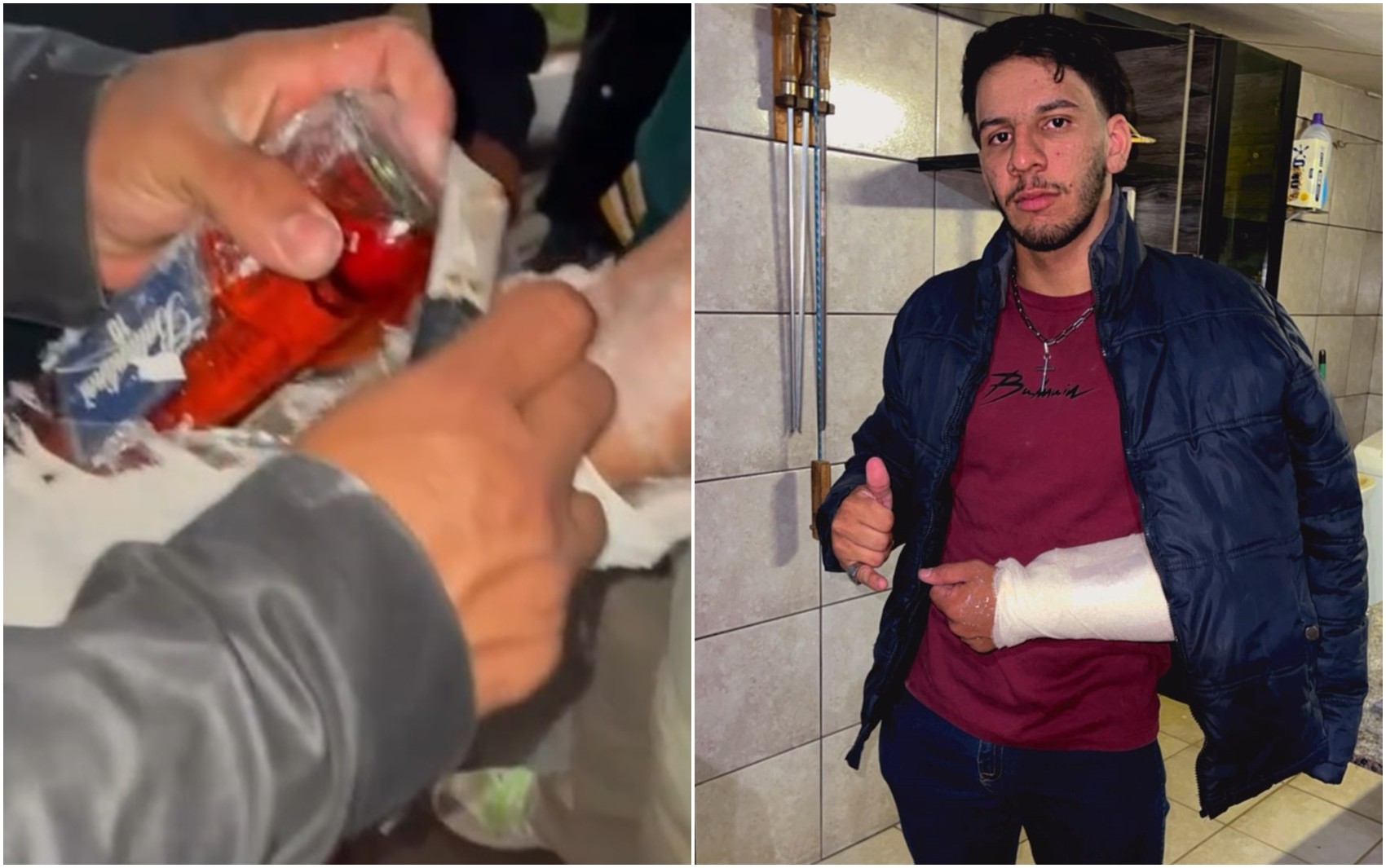 Jovem tenta entrar com garrafa de uísque no braço engessado e é barrado em festa; vídeo