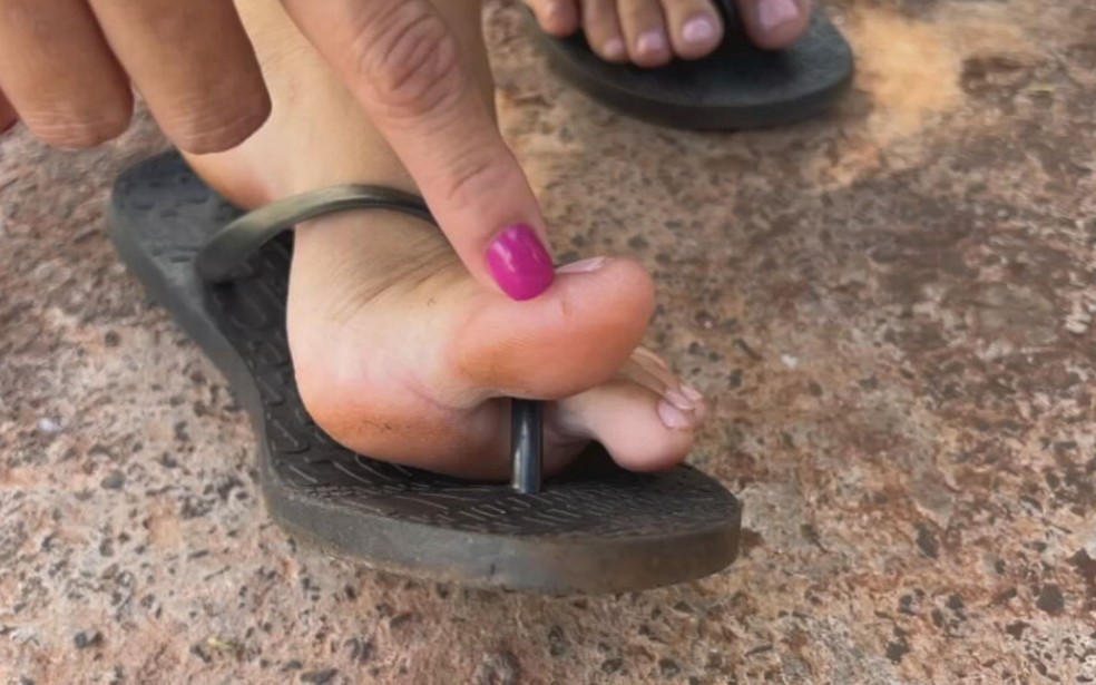 Mulher foi picada no pé esquerdo em Indiaporã (SP) — Foto: Reprodução / TV TEM