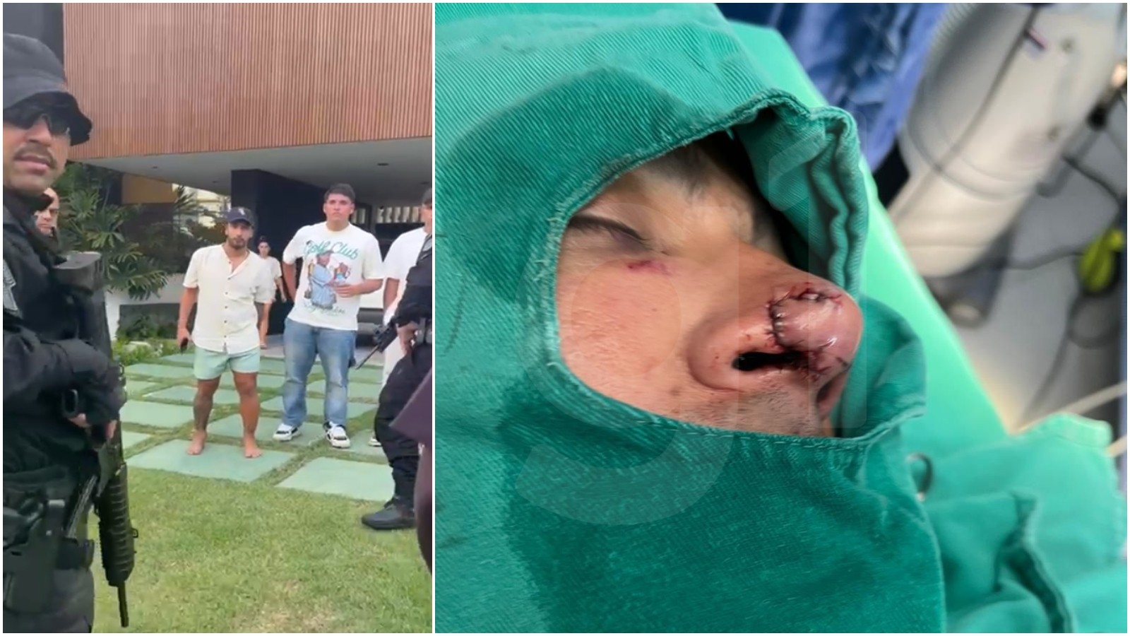 Homem diz que jogador argentino mordeu e cortou seu nariz durante confusão no Ceará