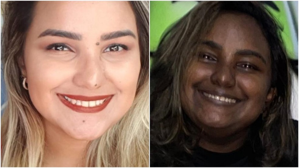 Sabrina Gomes tem doença rara que, entre outros sintomas, alterou a tonalidade de sua pele — Foto: Reprodução
