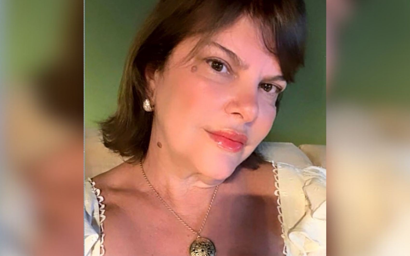 Mãe de vereador morre após procedimento estético, em Goiânia