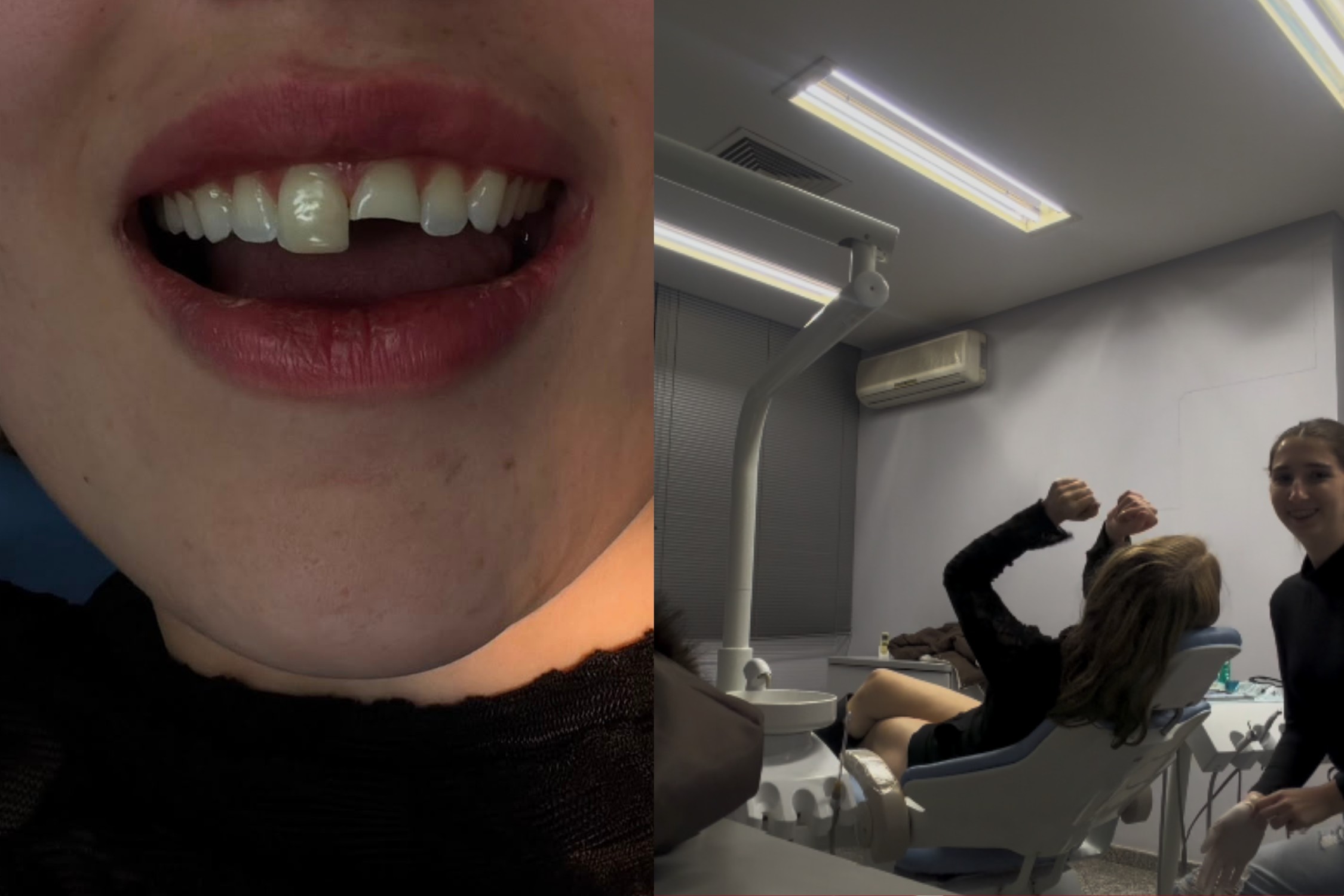 Jovem que quebrou dente na balada no PR foi atendida por amiga dentista de madrugada: 'Ela é um amor'