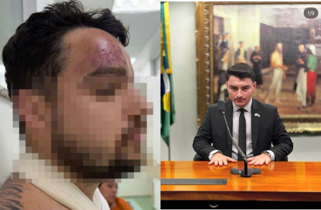 Assessor de Jair Renan é investigado por agredir primo com garrafadas após vitória de Lula