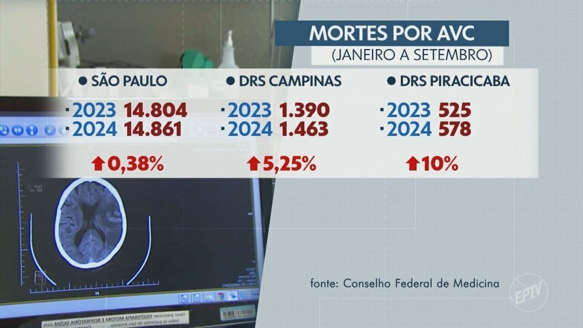 Mortes por AVC de pessoas com menos de 60 anos crescem em Campinas