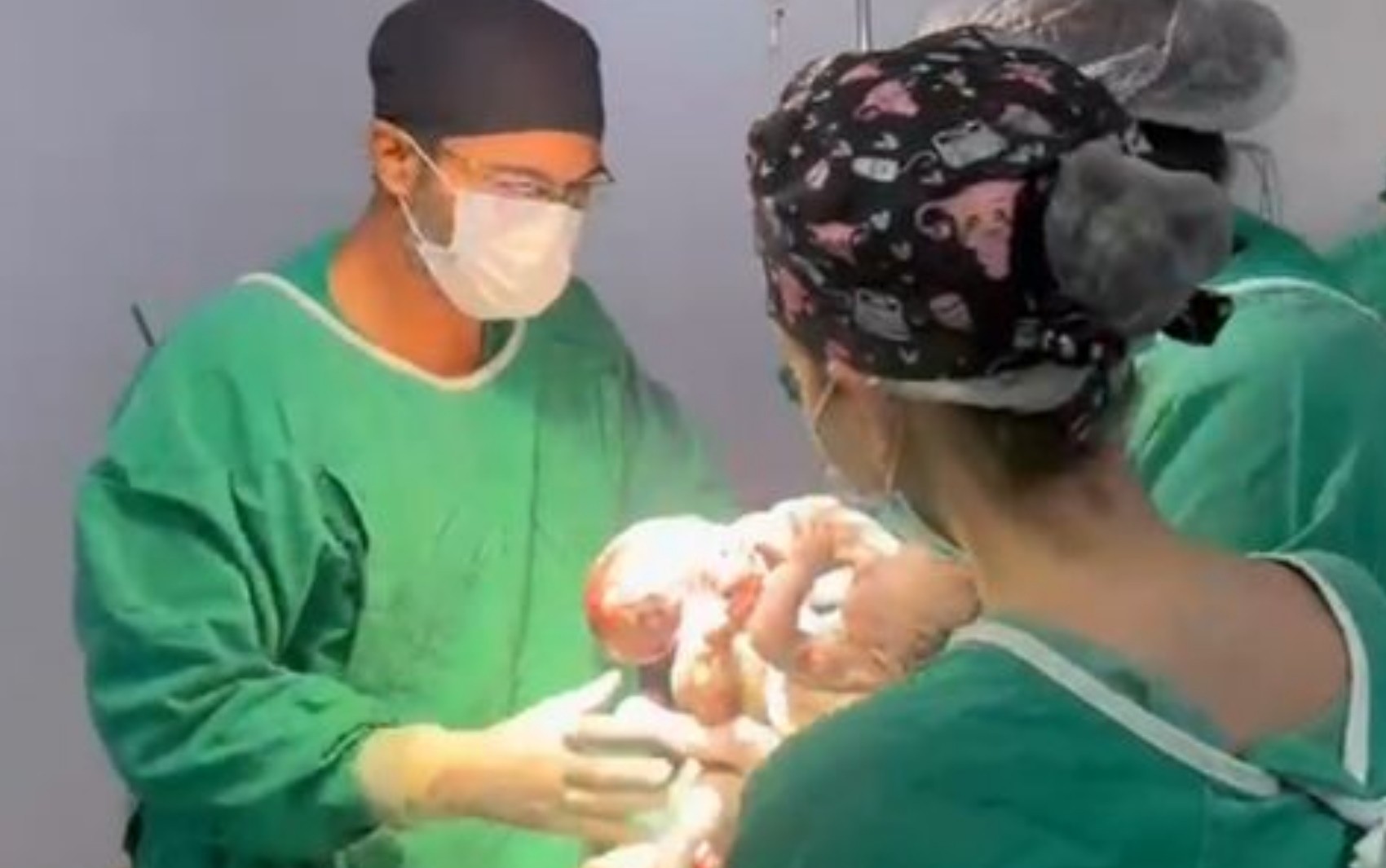 Gêmeos siameses do Mato Grosso nascem em Goiânia