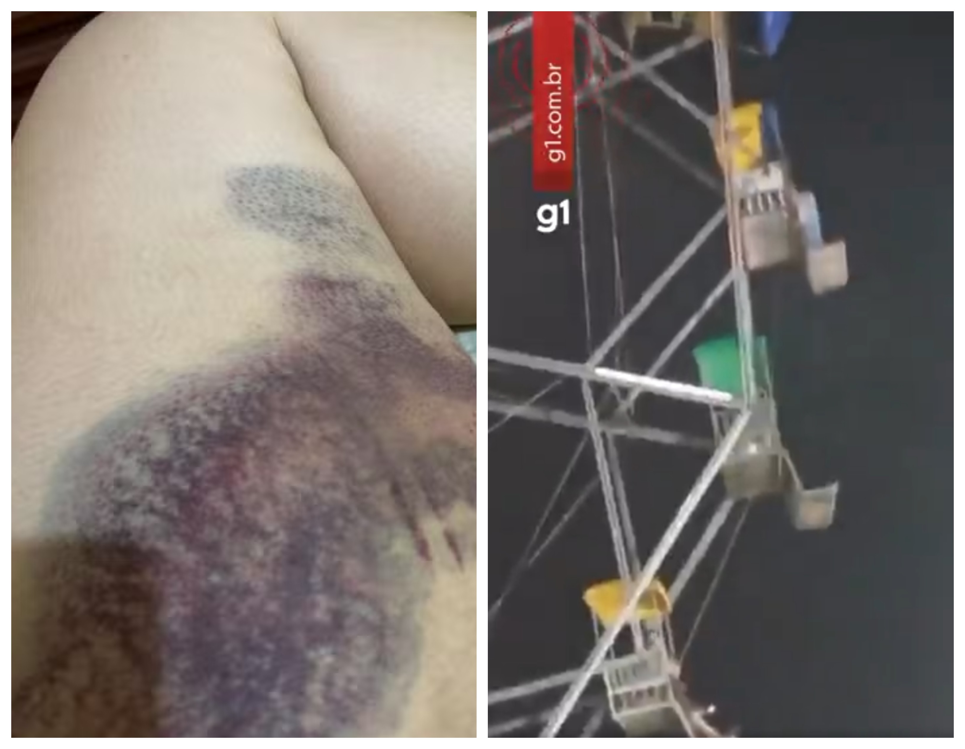 'Foi queda livre', diz mulher que caiu de assento de roda-gigante em parque no AC