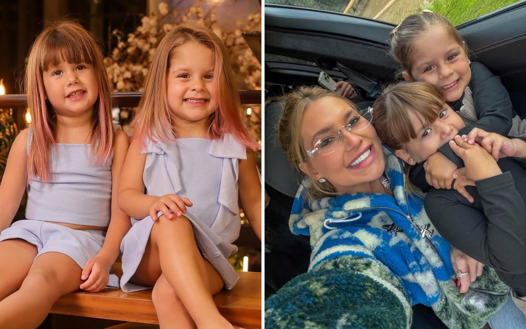 Filhas de Virginia: entenda como é a cirurgia que elas irão fazer