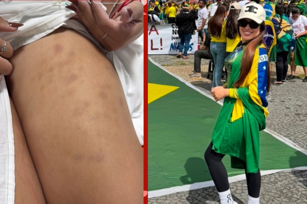 'Levei choque no peito e só tremia', relata empresária de Cuiabá atingida por raio em manifestação em Brasília