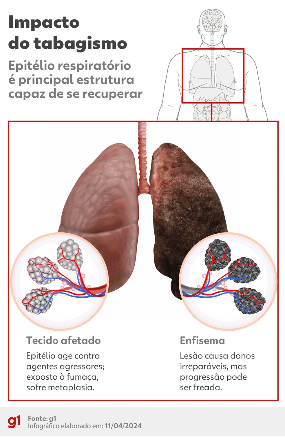 Impacto do tabagismo nos pulmões — Foto: Arte/g1