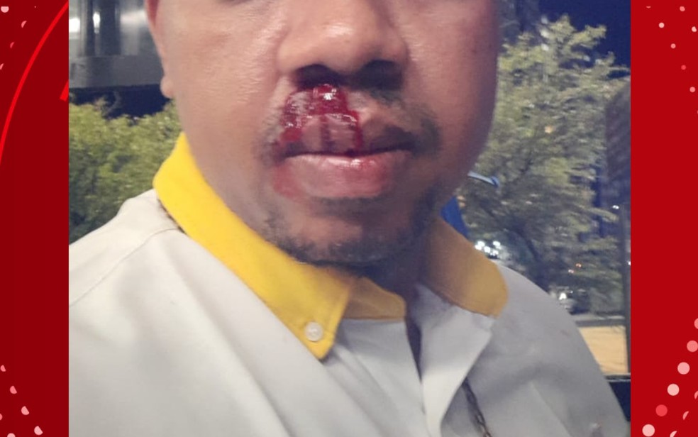 Motorista foi agredido com lata de cerveja em Salvador — Foto: Arquivo pessoal