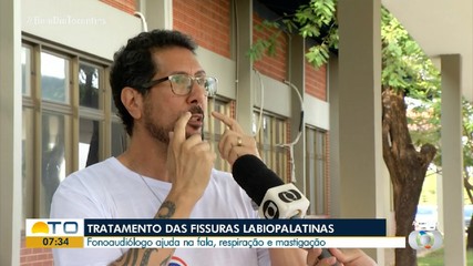 Fonoaudiologia pode ajudar na fala e respiração para paciente com fissura labiopalatina