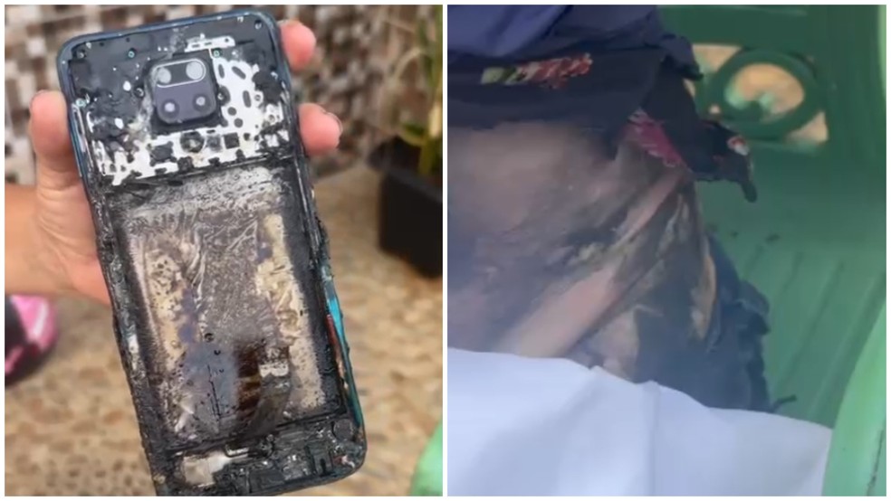 Celular pega fogo em cintura de mulher, no Ceará. — Foto: Imagens pessoais