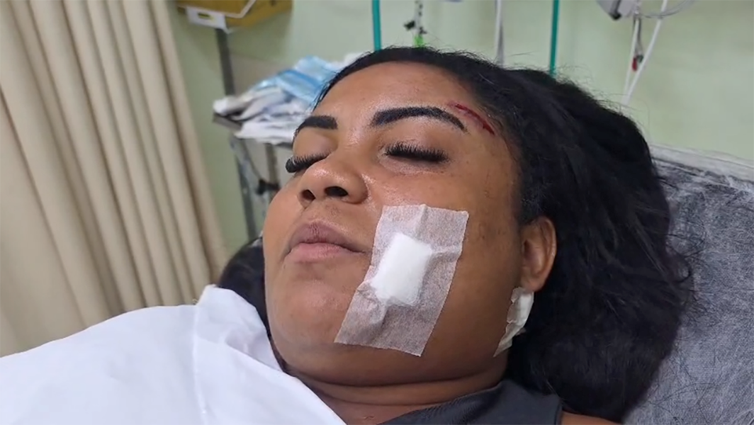 Mulher sofre tentativa de feminicídio a tiros, e ex-marido é preso: ‘Ele queria atirar mais, mas a arma travou’