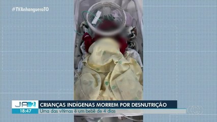 Duas crianças indígenas morrem por desnutrição no Tocantins; saiba mais
