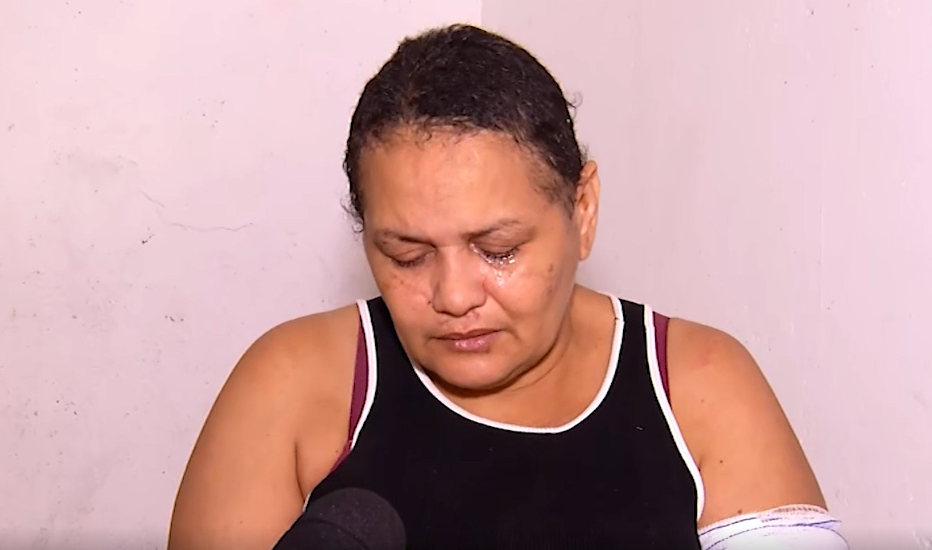 Com 283 pontos na cabeça, vítima relata tentativa de feminicídio pelo ex, em Fortaleza: 'Vivo com medo'