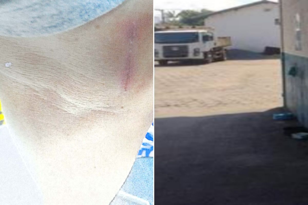 TJ-SP nega indenização a servidor agredido com enxada por colega no litoral de SP