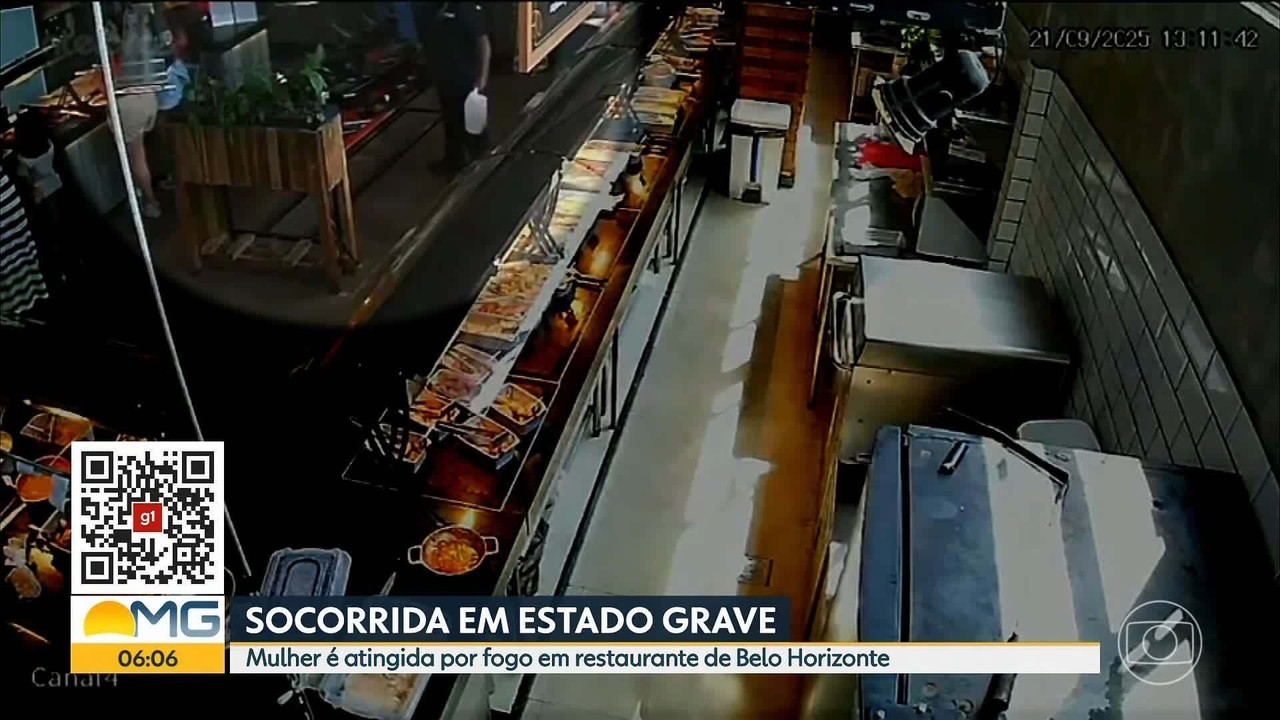 Mulher que teve cabelo em chamas em restaurante não consegue se mexer nem para comer e segue internada, diz filho 