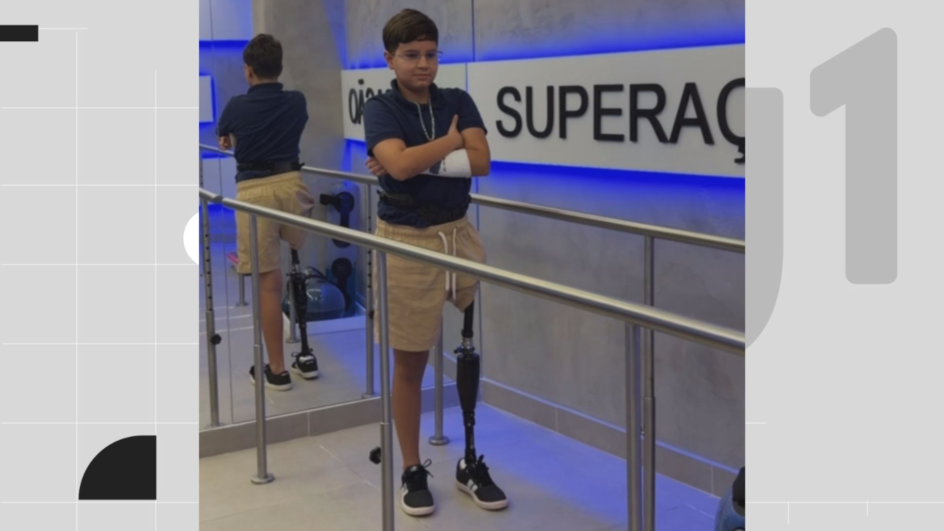 Menino que teve perna amputada após ataque de tubarão começa reabilitação com prótese; VÍDEO