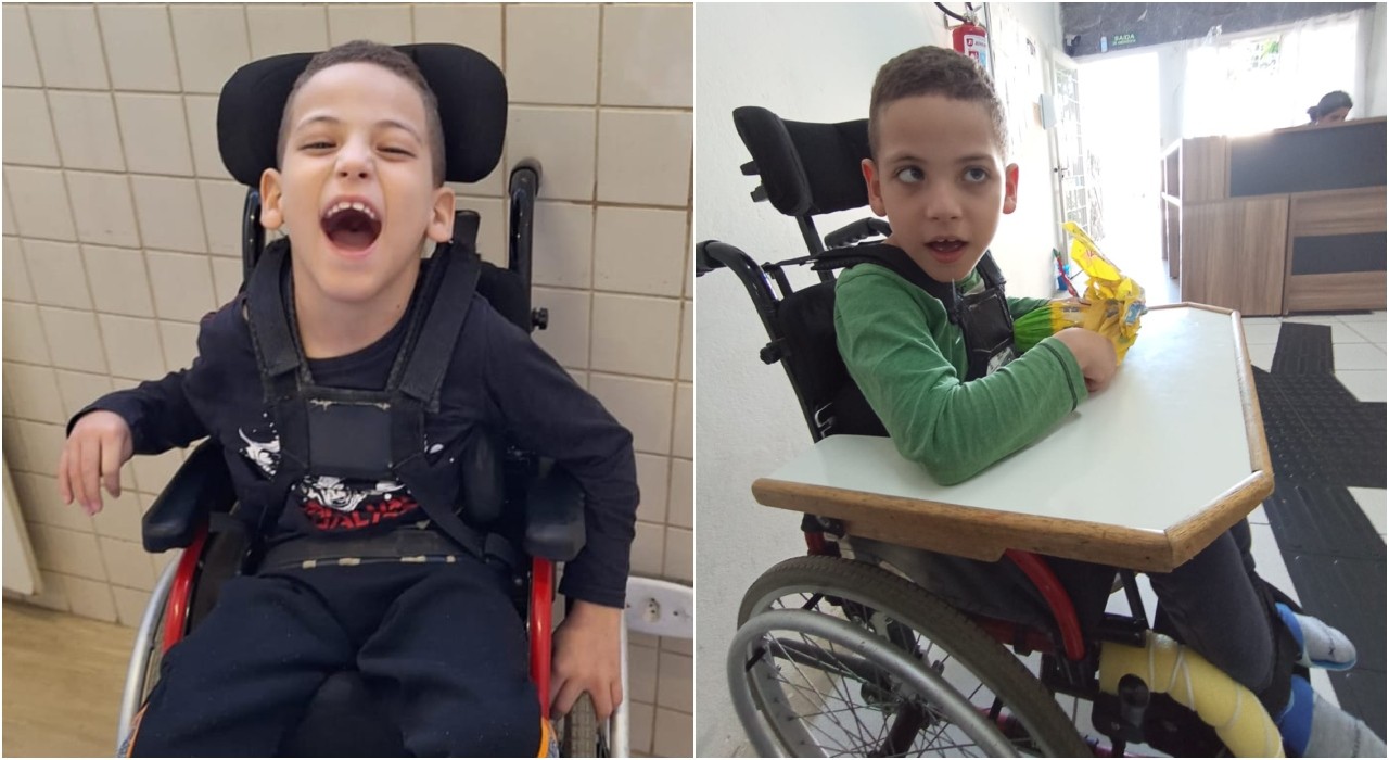 Síndrome de West: conheça tipo de epilepsia rara que atrasa desenvolvimento infantil e causa convulsões 