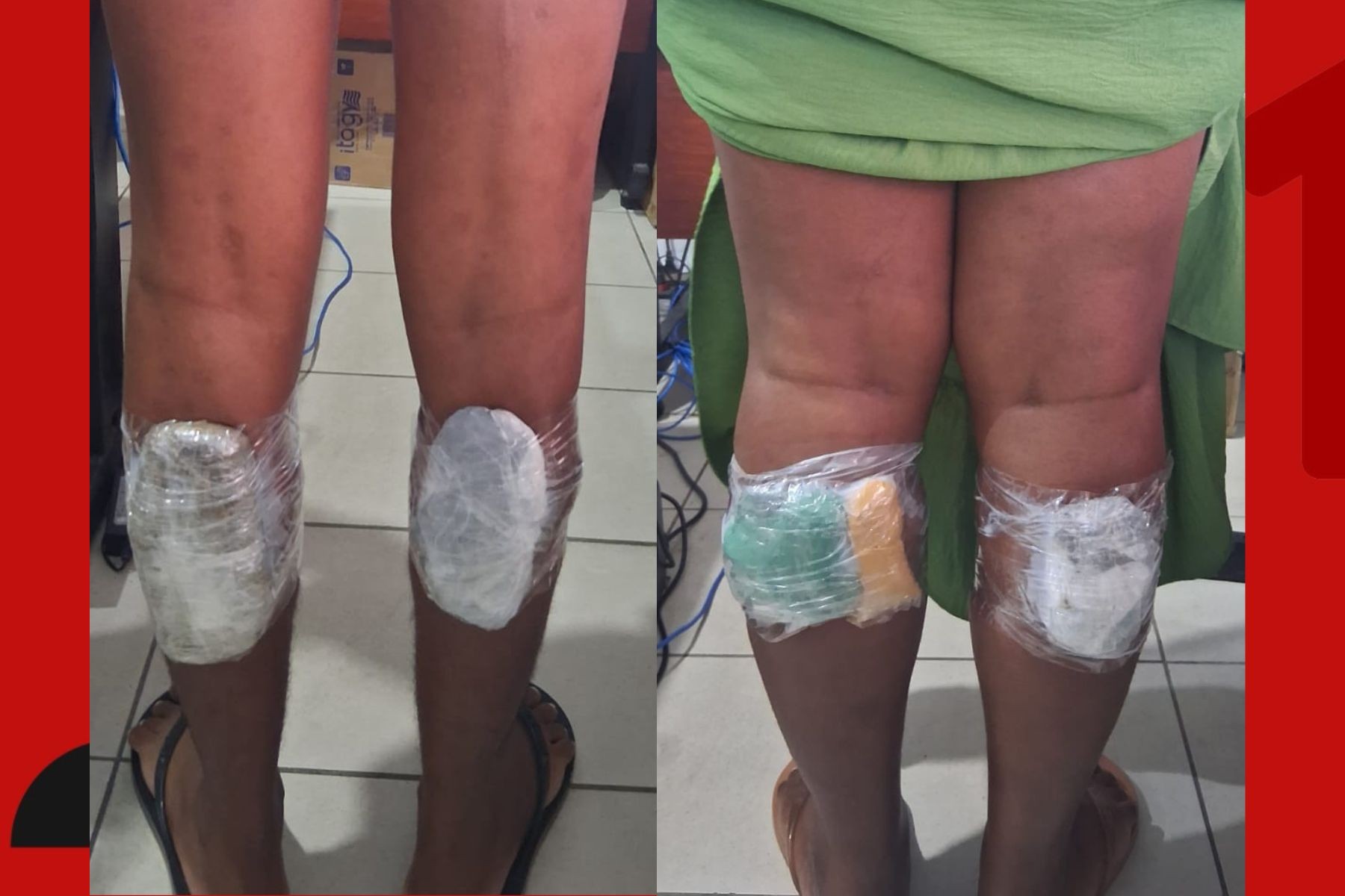 Scanner flagra cinco mulheres com drogas nas panturrilhas em presídio de Salvador