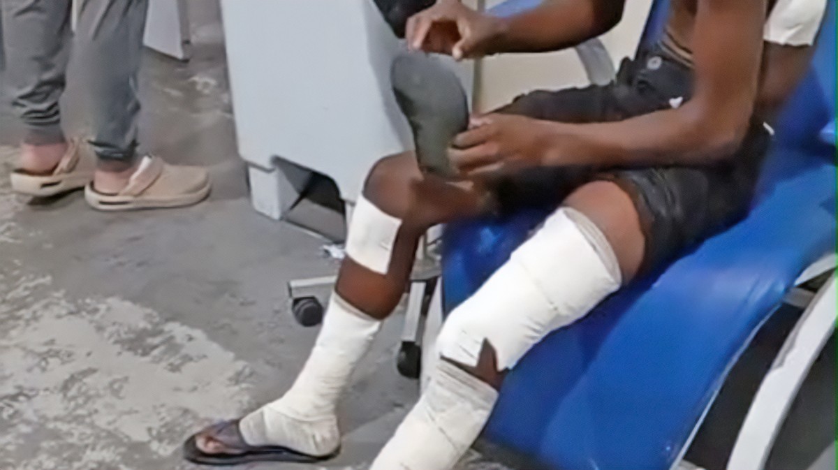 Bomba caseira explode em escola de Belford Roxo e fere pelo menos 10 alunos