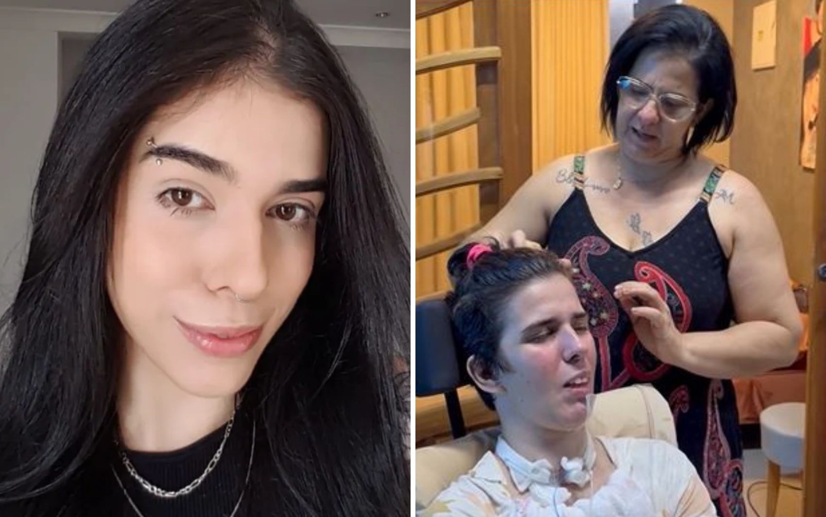 Mãe de jovem que teve reação grave após cheirar pimenta diz que já não sabe mais o que fazer: '1 mil dias mais doloridos da minha vida'