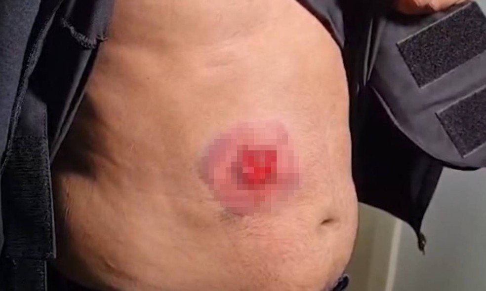 Bala perfurou parcialmente o colete e deixou ferimento na barriga de policial na Bahia — Foto: Reprodução/TV Bahia
