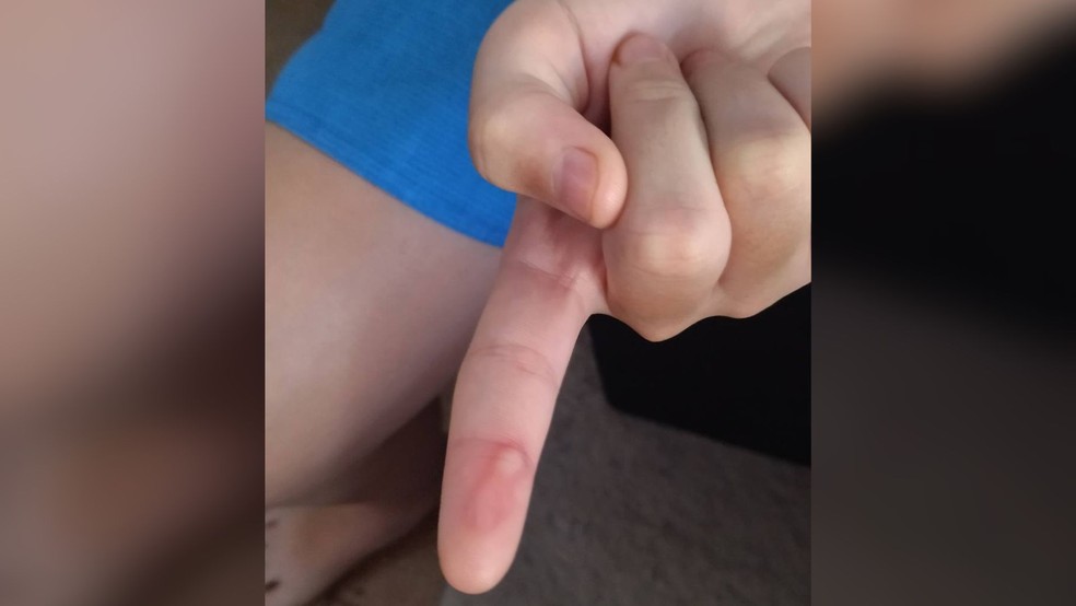 Professora é suspeita de queimar dedo de alunos em escola municipal de Birigui (SP) — Foto: Arquivo Pessoal