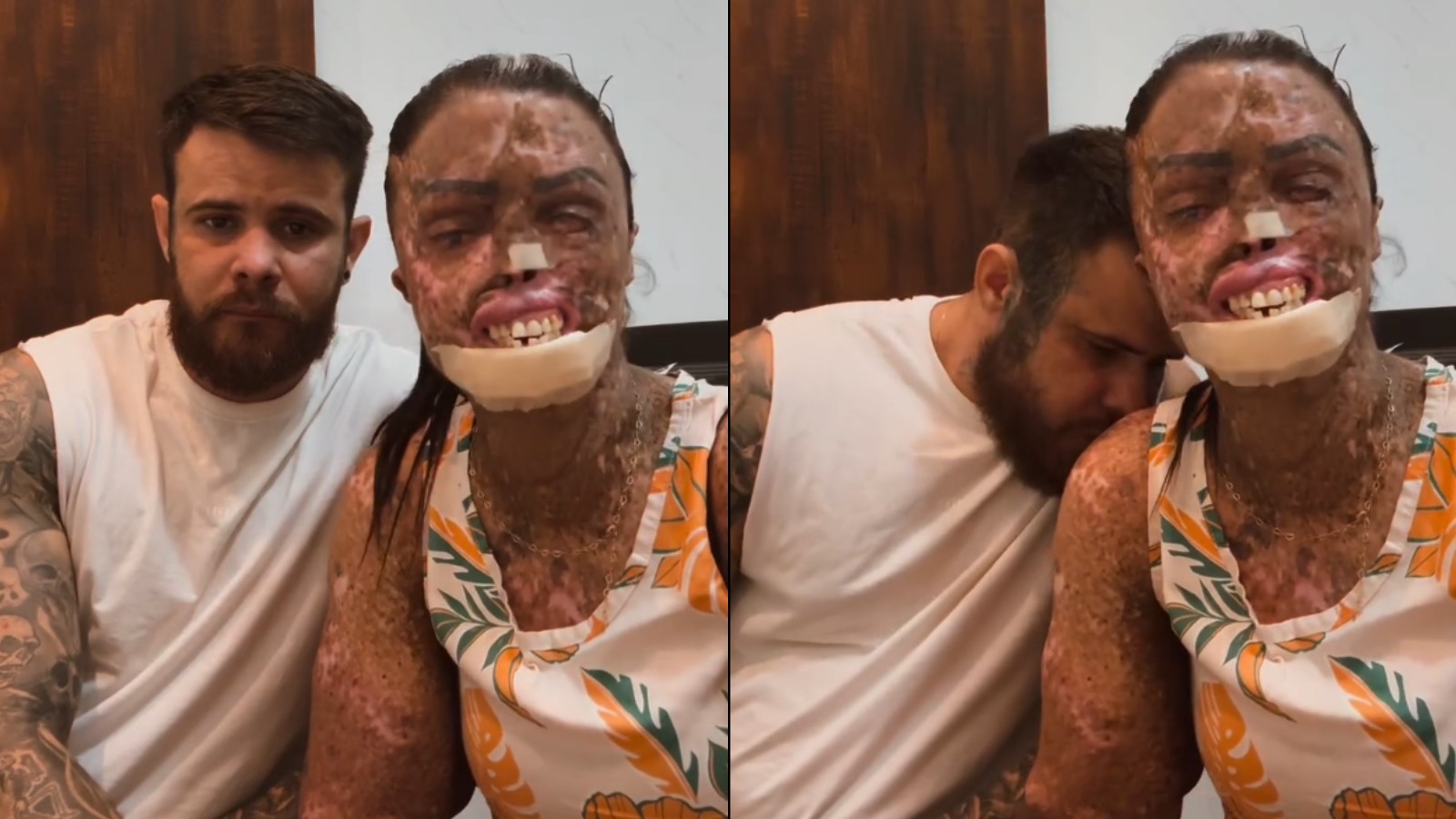 Influencer cearense com doença rara revela diagnóstico de metástase: ‘Difícil continuar sendo forte’